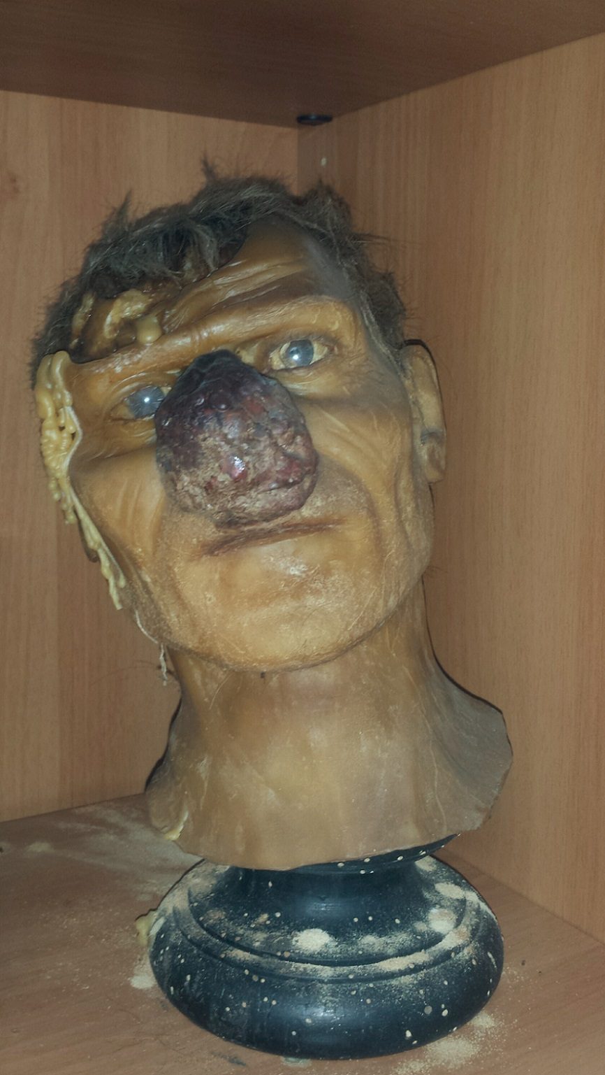 Antonio Cardarelli's Hospital anatomical preparations (4).jpg